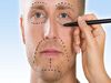 روش های لیفت صورت: از تزریق ژل تا جراحی